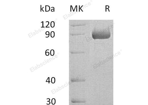 Recombinant Human SEMA4B Protein (His Tag) - ABMIUM