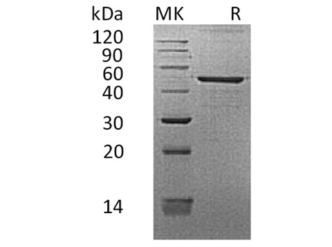 Recombinant Human REG3G/PAP-1B Protein (Fc Tag) - ABMIUM