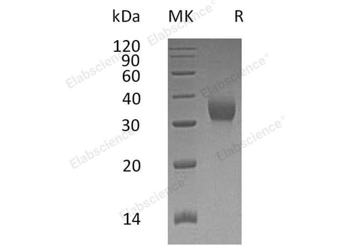 Recombinant Human CEACAM21 Protein (His Tag) - ABMIUM