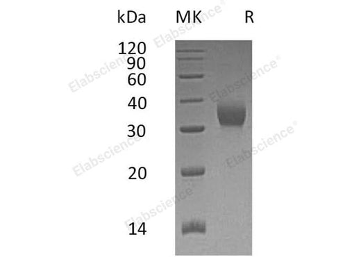 Recombinant Human CEACAM21 Protein (His Tag) - ABMIUM