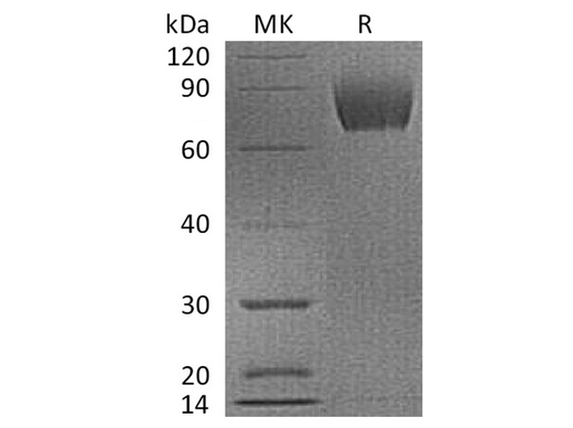 Recombinant Cynomolgus B7-H3/CD276 Protein (His Tag) - ABMIUM