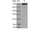 Recombinant Mouse ICAM-1/CD54 Protein (His & Fc Tag) - ABMIUM