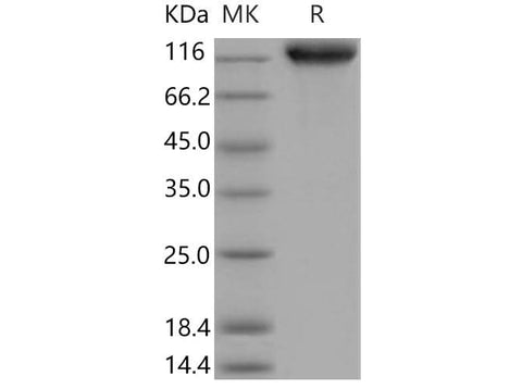 Recombinant Mouse ICAM-1/CD54 Protein (His & Fc Tag) - ABMIUM