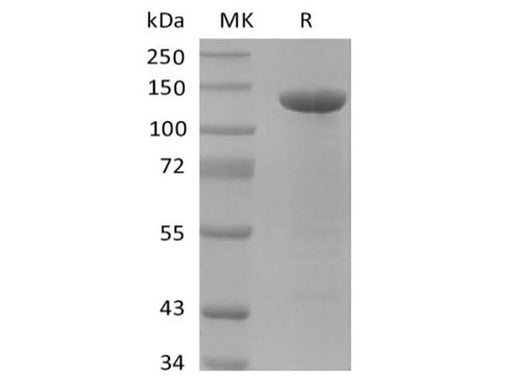 Recombinant Human Amyloid Precursor (C-FC) - ABMIUM