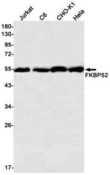 Western blot detection of FKBP52 in Jurkat,C6,CHO-K1,Hela cell lysates using FKBP52 Rabbit mAb(1:500 diluted).Predicted band size:52kDa.Observed band size:52kDa.