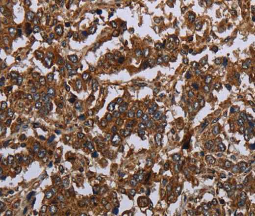 Anti-Human/Mouse/Rat HOMER2 Antibody