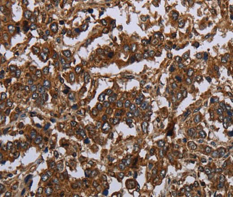 Anti-Human/Mouse/Rat HOMER2 Antibody - ABMIUM