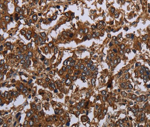 Anti-Human/Mouse/Rat HOMER2 Antibody - ABMIUM