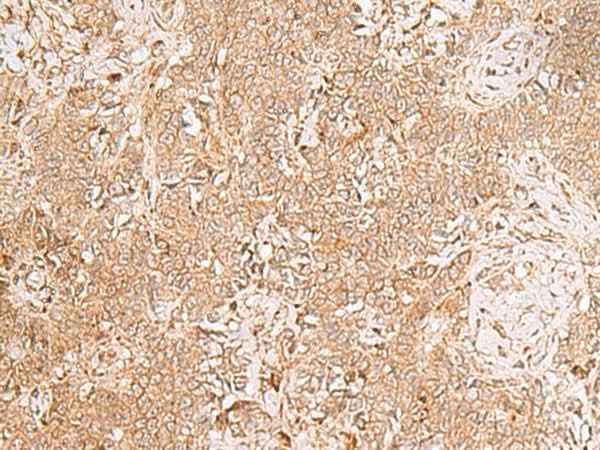 Anti-Human/Mouse GMPPB Antibody
