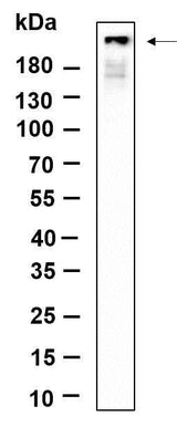 Anti-Human/Mouse IRF3 Antibody [B1156]