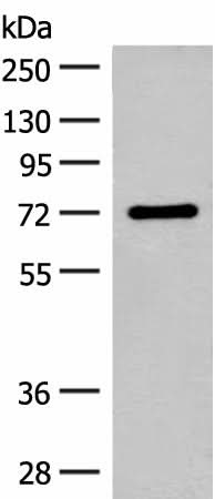 Anti-Human/Mouse/Rat SLC6A11 Antibody - ABMIUM