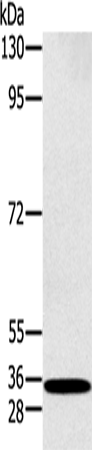 Anti-Human/Mouse/Rat RAB27A Antibody - ABMIUM