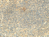 Immunohistochemistry of paraffin-embedded Human tonsil tissue using ARL4D Polyclonal Antibody at dilution of 1:50(×200)