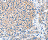 Anti-Human ADAM20 Antibody - ABMIUM