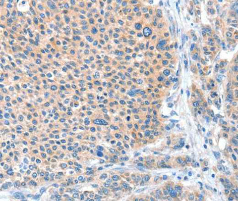 Anti-Human ADAM20 Antibody