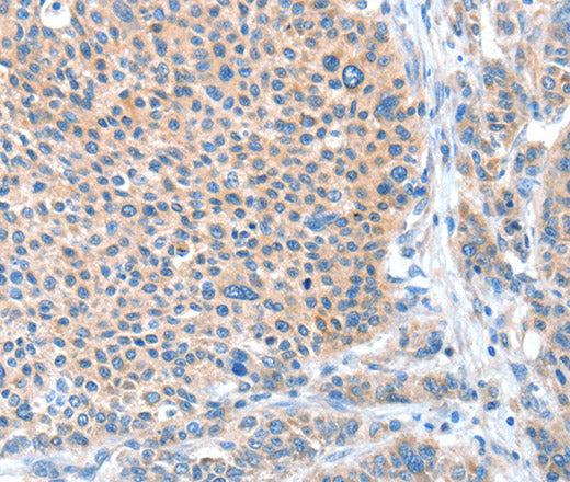 Anti-Human ADAM20 Antibody - ABMIUM