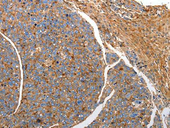 Anti-Human/Mouse/Rat CD151 Antibody