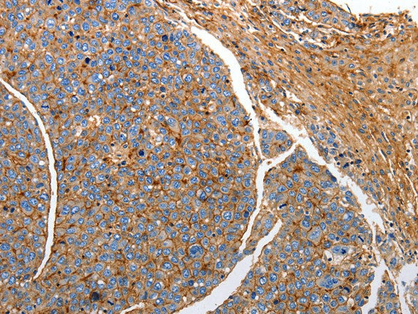 Anti-Human/Mouse/Rat CD151 Antibody - ABMIUM