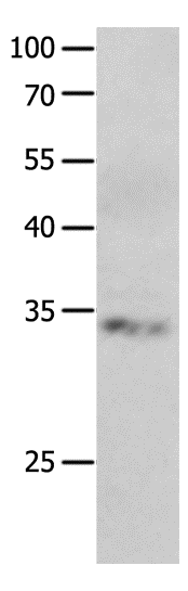 Anti-Human/Mouse RBFOX3 Antibody - ABMIUM