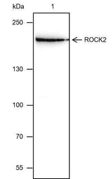 Anti-Human/Rat/Mouse ROCK2 Antibody [A352]