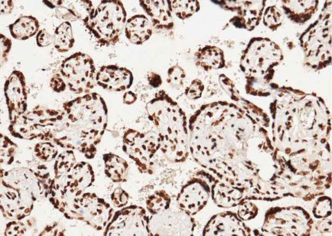 Anti-Human CCNE1 Antibody [A1045] - ABMIUM