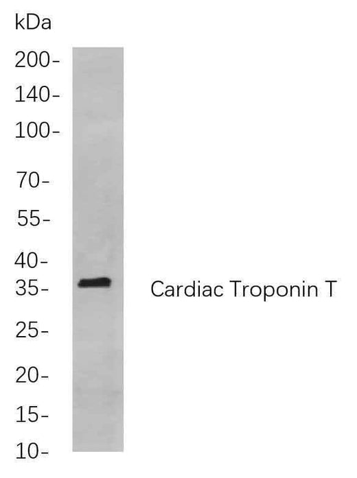 Anti-Human/Mouse/Rat Cardiac Troponin T Antibody [B844] - ABMIUM