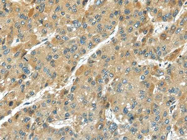 Anti-Human TMPRSS11D Antibody
