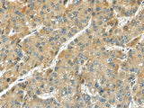 Anti-Human TMPRSS11D Antibody - ABMIUM