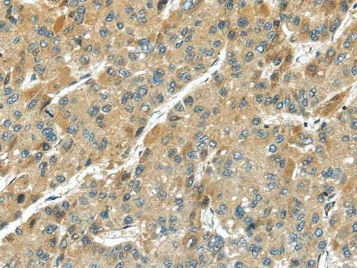 Anti-Human TMPRSS11D Antibody