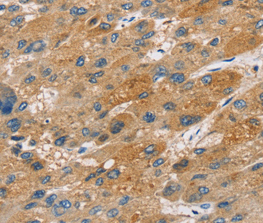 Anti-Human/Mouse/Rat ST18 Antibody - ABMIUM