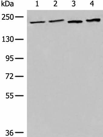 Western blot analysis of 293T cell Human metastatic malignant melanoma tissue lysates using EEA1 Polyclonal Antibody at dilution of 1:700