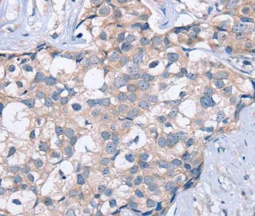 Anti-Human/Mouse KCNQ5 Antibody