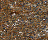 Anti-Human/Mouse IVL Antibody - ABMIUM