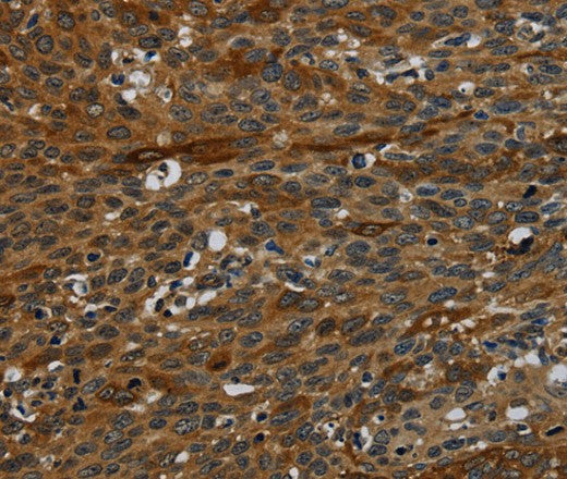 Anti-Human/Mouse IVL Antibody - ABMIUM
