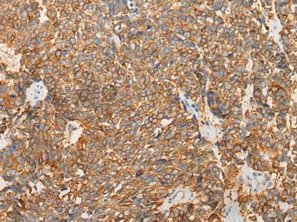 Anti-Human/Mouse LRRC16A Antibody