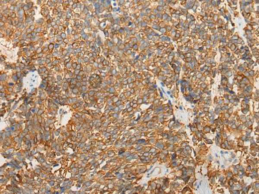 Anti-Human/Mouse LRRC16A Antibody