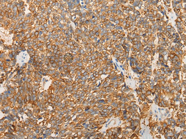 Anti-Human/Mouse LRRC16A Antibody - ABMIUM