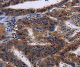 Anti-Human HTR2B Antibody - ABMIUM