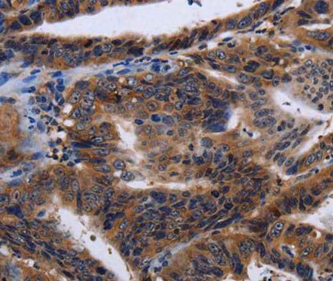 Anti-Human HTR2B Antibody