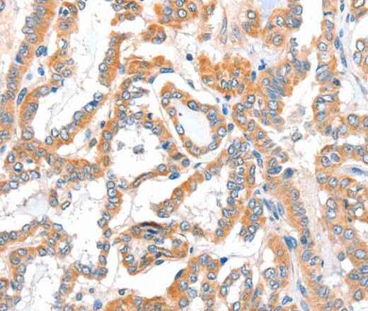 Anti-Human/Mouse/Rat ACSBG1 Antibody