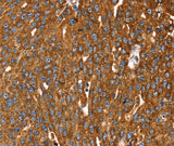 Anti-Human/Mouse RASSF3 Antibody - ABMIUM