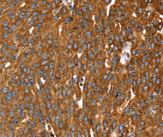 Anti-Human/Mouse RASSF3 Antibody - ABMIUM