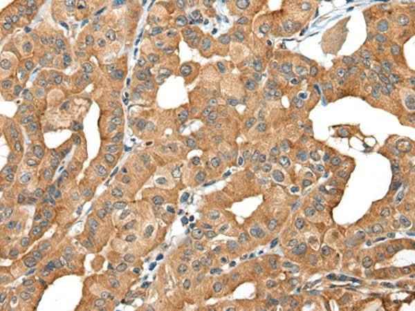 Anti-Human/Mouse INF2 Antibody