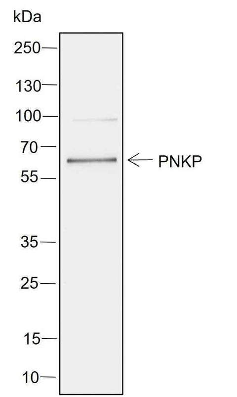 Anti-Human PNKP Antibody [A752] - ABMIUM