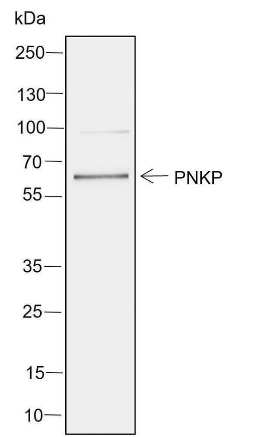 Anti-Human PNKP Antibody [A752] - ABMIUM