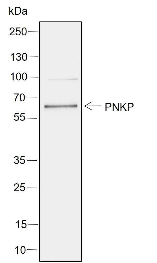 Anti-Human PNKP Antibody [A752]