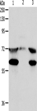 Anti-Human/Mouse SPDL1 Antibody - ABMIUM