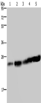 Anti-Human/Mouse/Rat MOB1A Antibody - ABMIUM