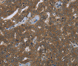 Anti-Human FASTKD1 Antibody - ABMIUM