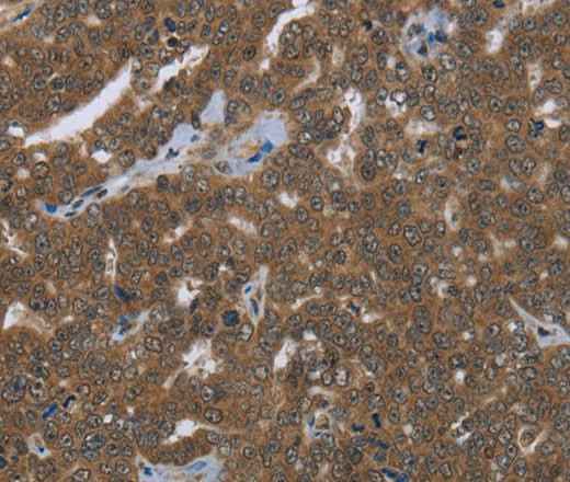Anti-Human FASTKD1 Antibody